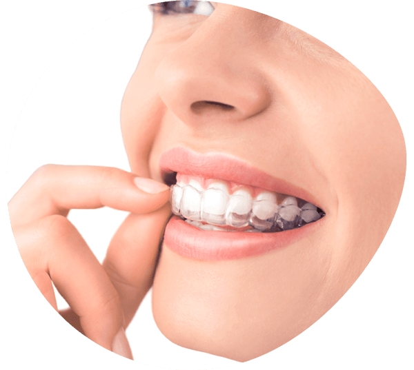 invisalign cancun